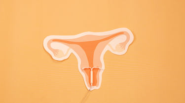 Tegning av kvinnelige reproduksjonsorganer med en innsatt spiral.