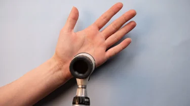 En hånd som blir undersøkt med et dermatoskop.