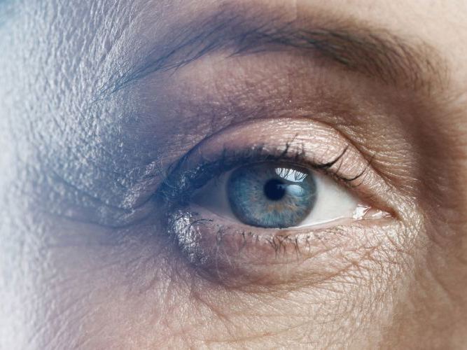 Nærbilde av et øye hos optiker | Aleris