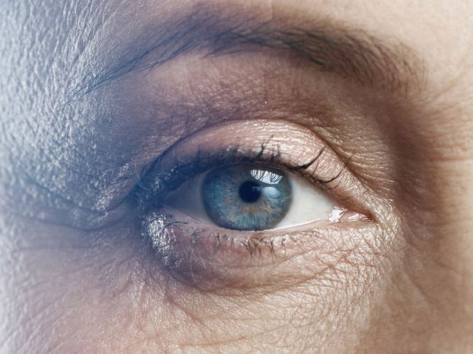 Nærbilde av et øye hos optiker | Aleris