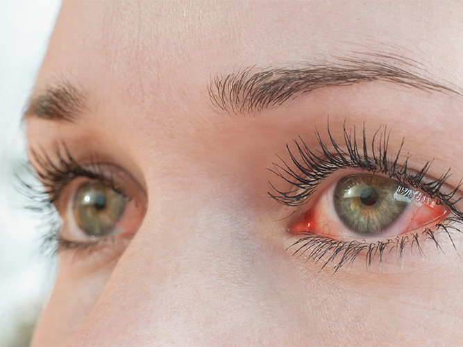 Nærbilde røde øyne