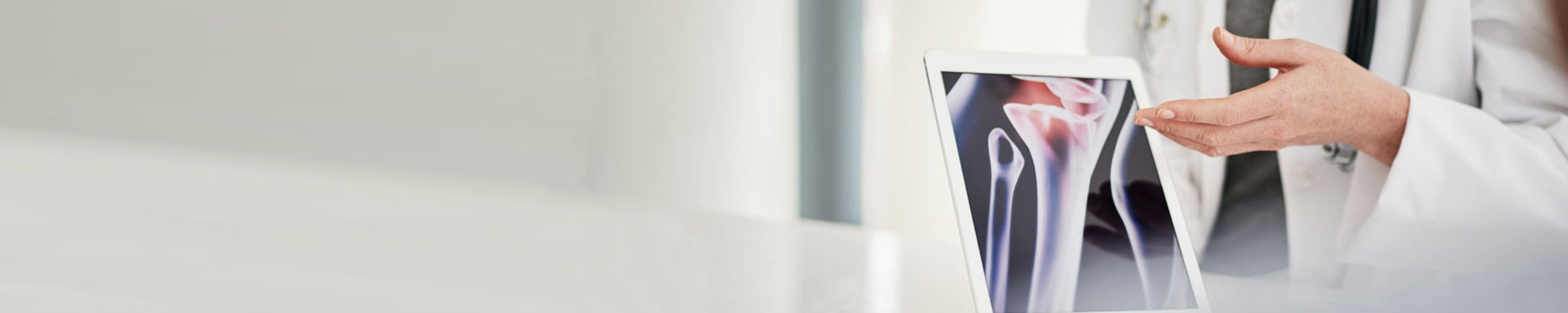 Revmatolog viser frem bilde av ledd