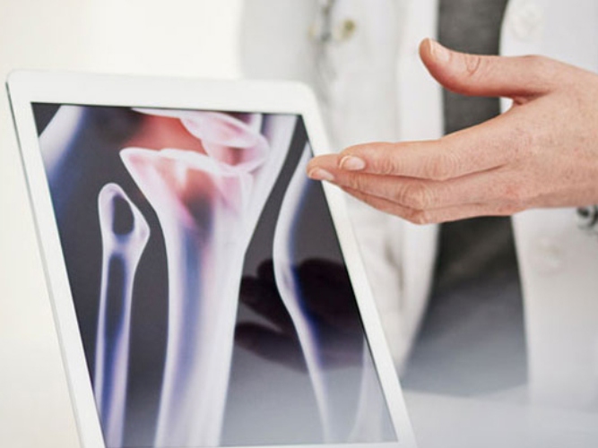 Revmatolog viser frem bilde av ledd