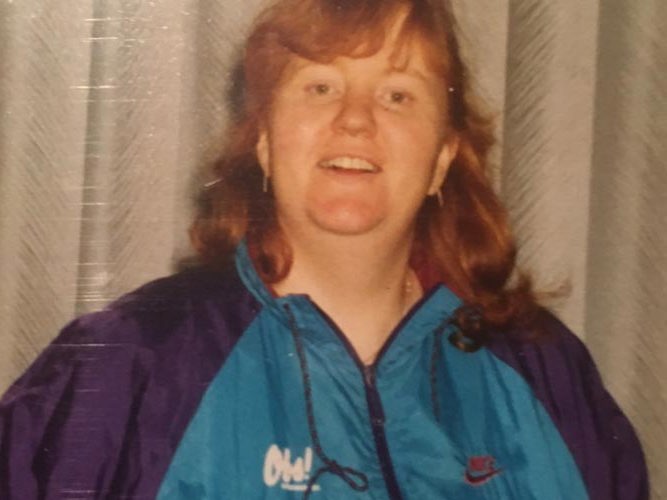 Jorunn før slankeoperasjon.