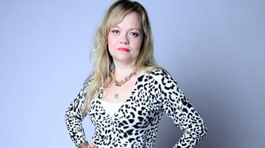 Marie etter slankeoperasjon. 