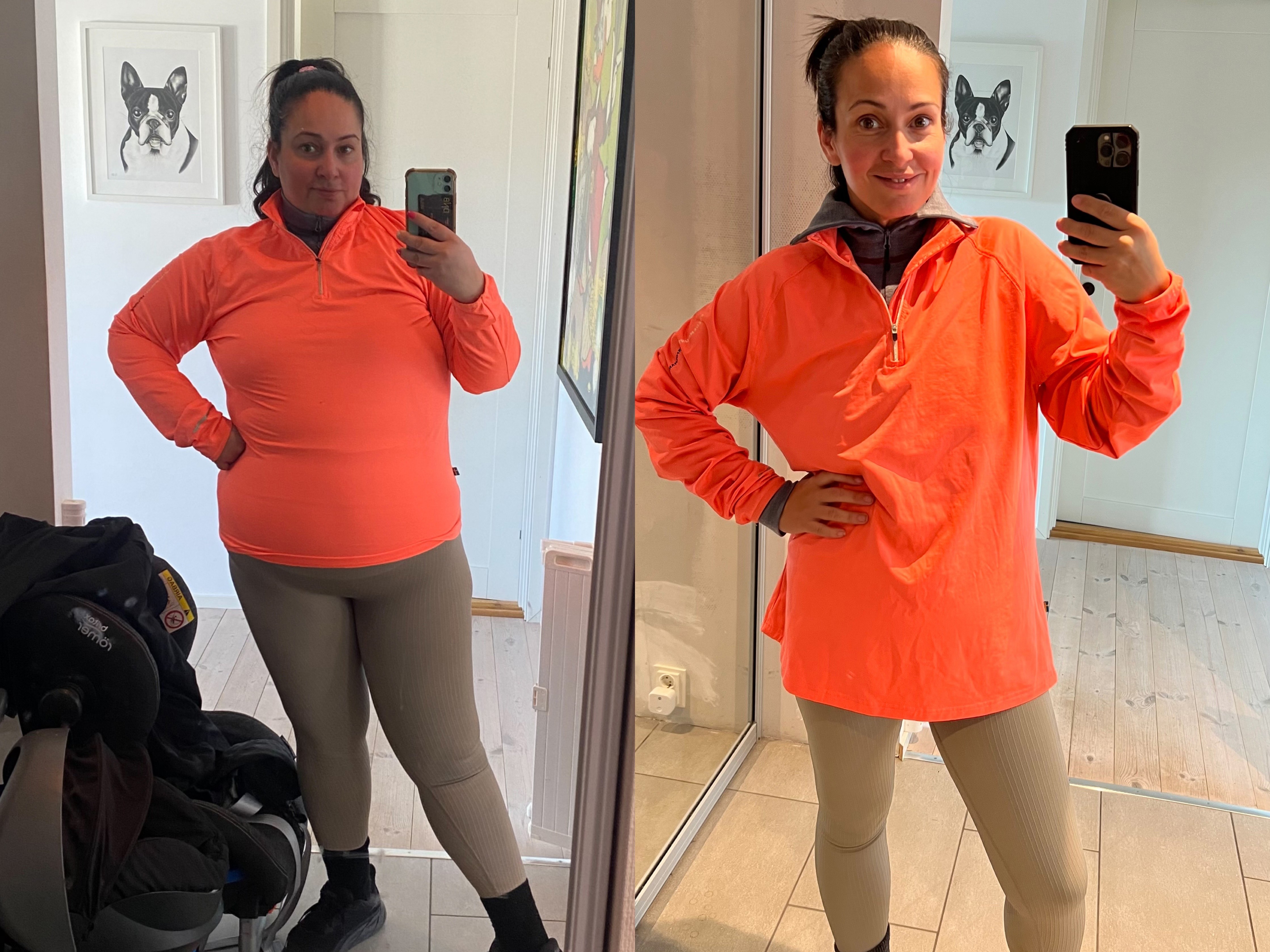 Kvinne før og etter SASI - betydelig endring