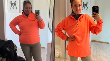 Kvinne før og etter SASI - betydelig endring